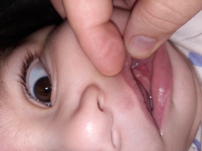 ilk dis olarak kopek disi cikmasi normal mi 6 12 ay arasi bebekler